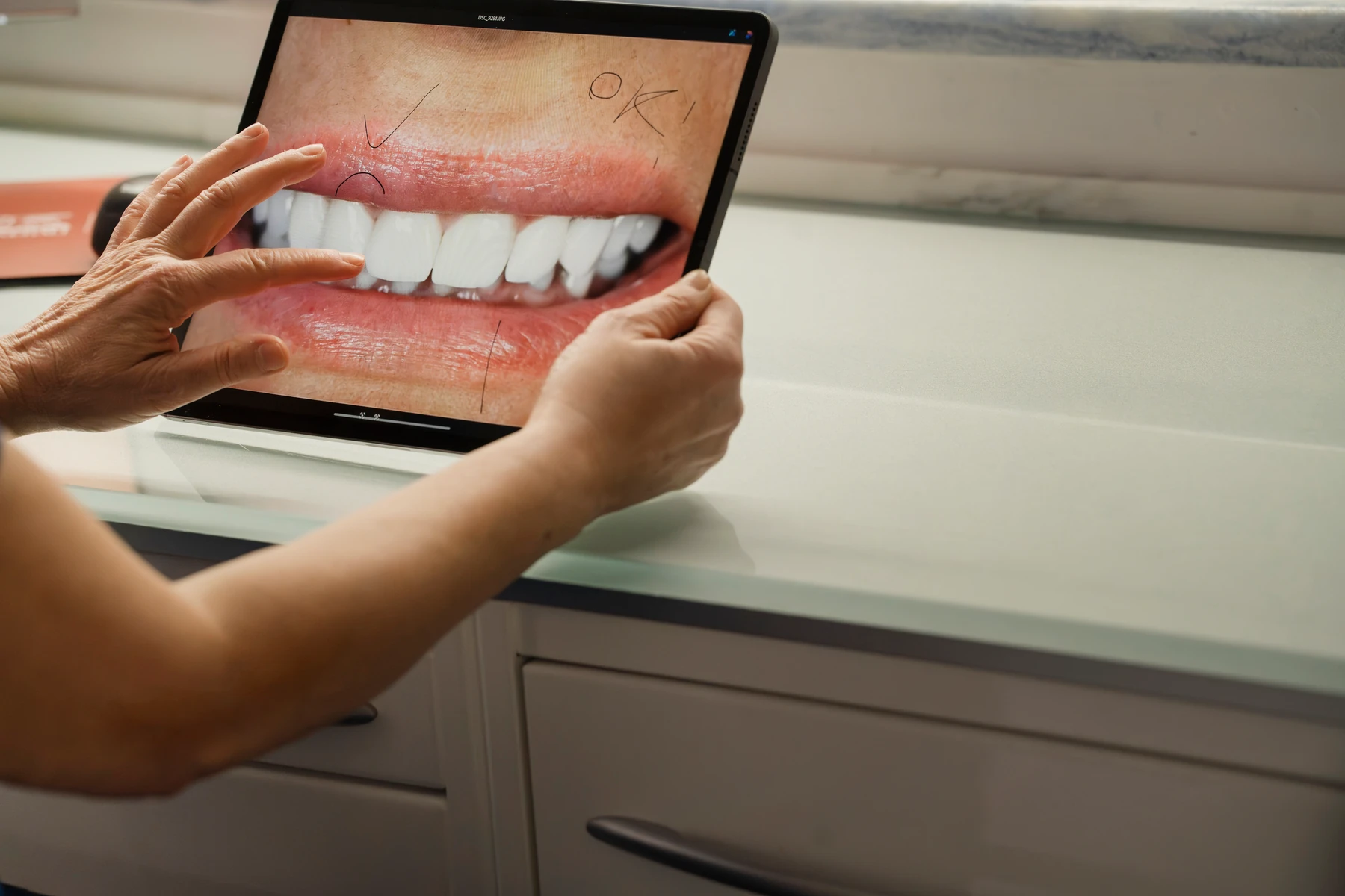 Dettaglio di una fotografia del sorriso mostrata sul tablet
